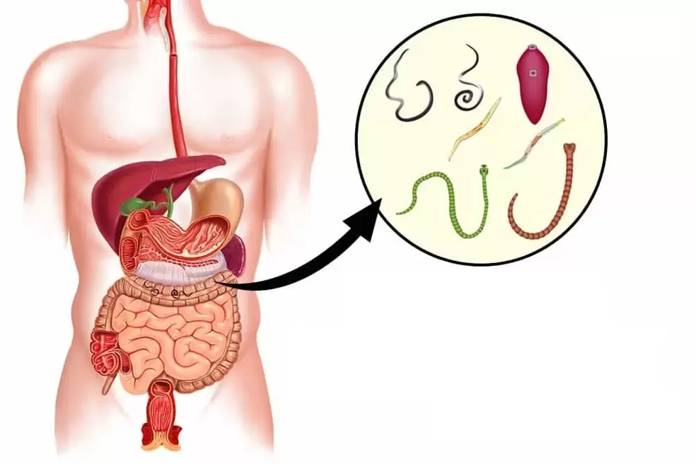 черви в организме человека