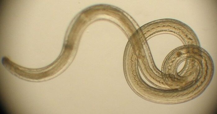 паразитический червь из человеческого тела